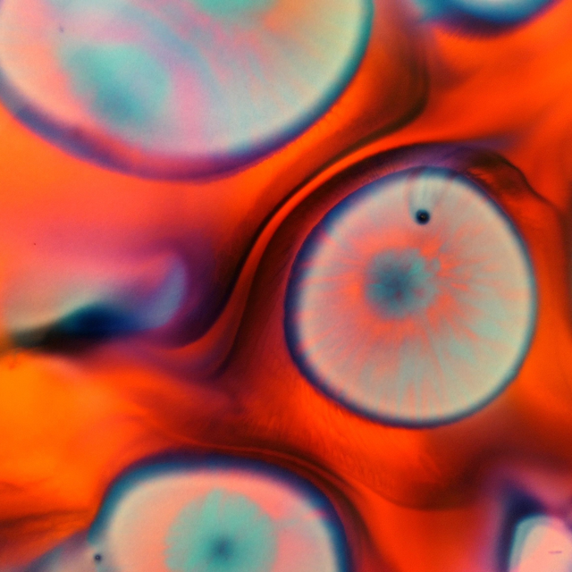 Gut flora profile